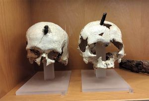 Cabeza decapitadas todavía con la estaca clavada.